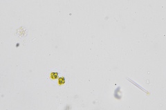 Radiococcaceae