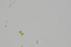 Radiococcaceae