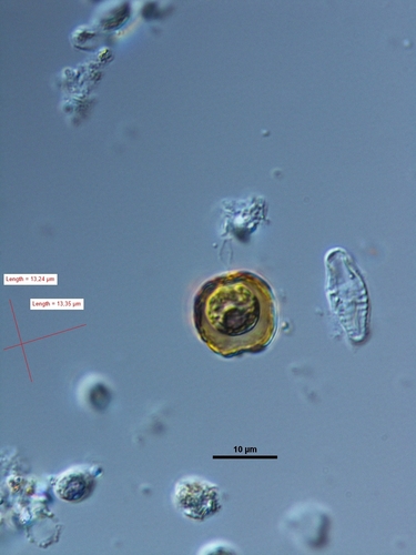 Dysmorphococcus