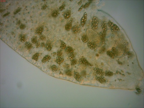 Stenostomum