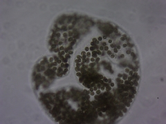 Microcystis wesenbergii