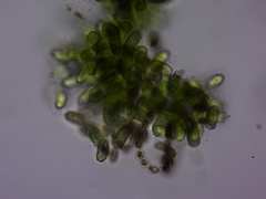 Dolichospermum lemmermannii