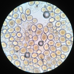 Sphaerosporium lignatile