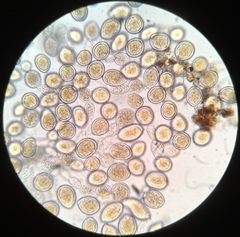 Sphaerosporium lignatile