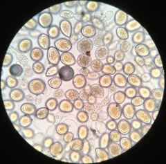 Sphaerosporium lignatile