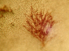 Acrochaetium secundatum
