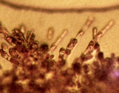 Acrochaetium secundatum