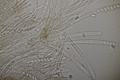 Ciboria batschiana
