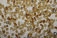 Puccinia tanaceti
