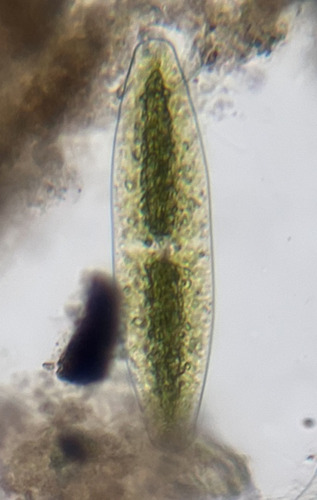 Netrium digitus var. lamellosum