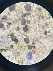 Cresponea chloroconia