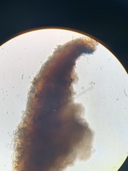 Cresponea chloroconia