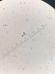 Cresponea chloroconia