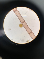 Coscinodiscophycidae