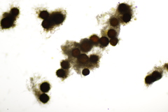 Golovinomyces echinopis