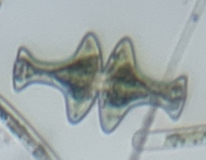 Euastrum intermedium var. longicolle