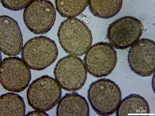 Puccinia acetosae