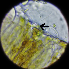 Intralichen lichenum