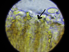 Intralichen lichenum