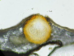 Xenonectriella subimperspicua