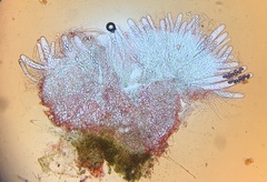 Ascobolus hawaiiensis