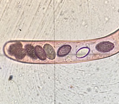 Ascobolus hawaiiensis