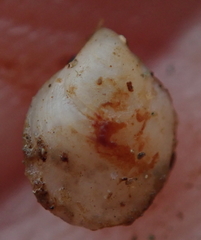 Philobrya acutangula