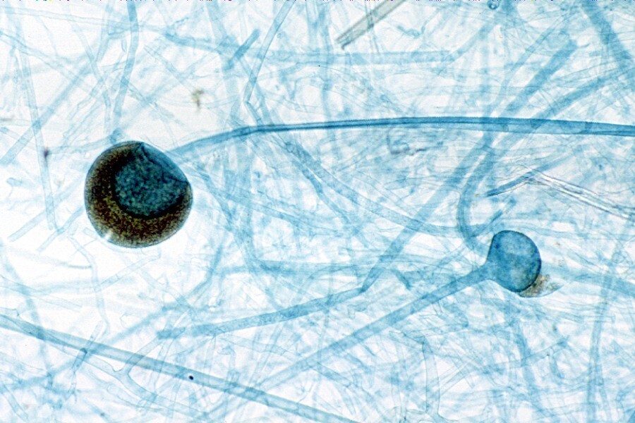 Rhizopus arrhizus
