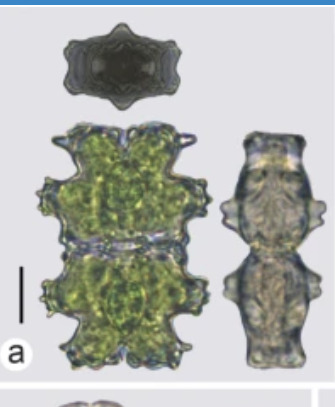 Euastrum abruptum var. abruptum