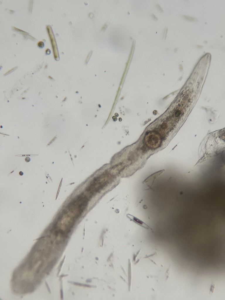 Stenostomum tuberculosum