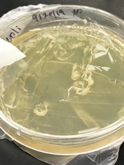 Escherichia coli