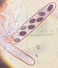 Ascobolus hawaiiensis