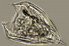 Lepadella rhomboides