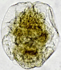 Asplanchnidae