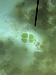 Chroococcus turgidus