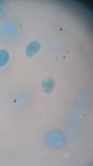 Clitocybe truncicola