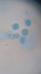 Clitocybe truncicola