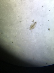 Simocephalus