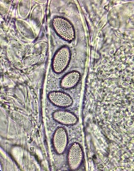 Ascobolus hawaiiensis