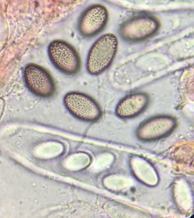 Ascobolus hawaiiensis