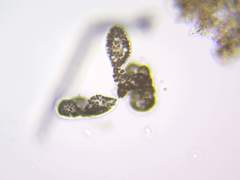 Microcystis wesenbergii