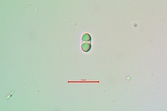 Polycauliona luteominia luteominia