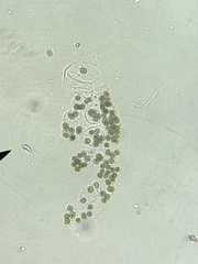 Microcystis wesenbergii