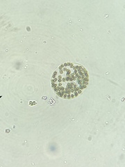 Microcystis wesenbergii
