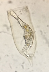 Favella