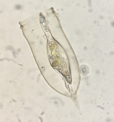 Favella