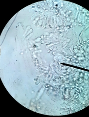 Leucoagaricus glabridiscus