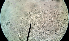 Leucoagaricus glabridiscus