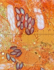 Saccobolus michiganensis