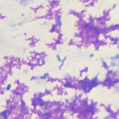 Campylobacteraceae